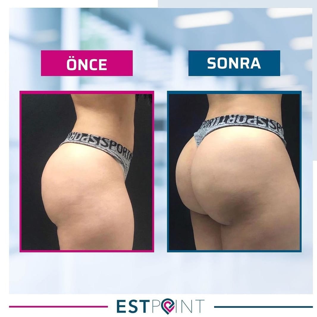 Brezilya Poposu Öncesi Sonrası